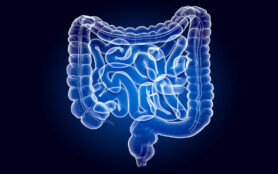 Human,Intestines,,X Ray,Hologram.,3d,Rendering,On,Dark,Blue,Background