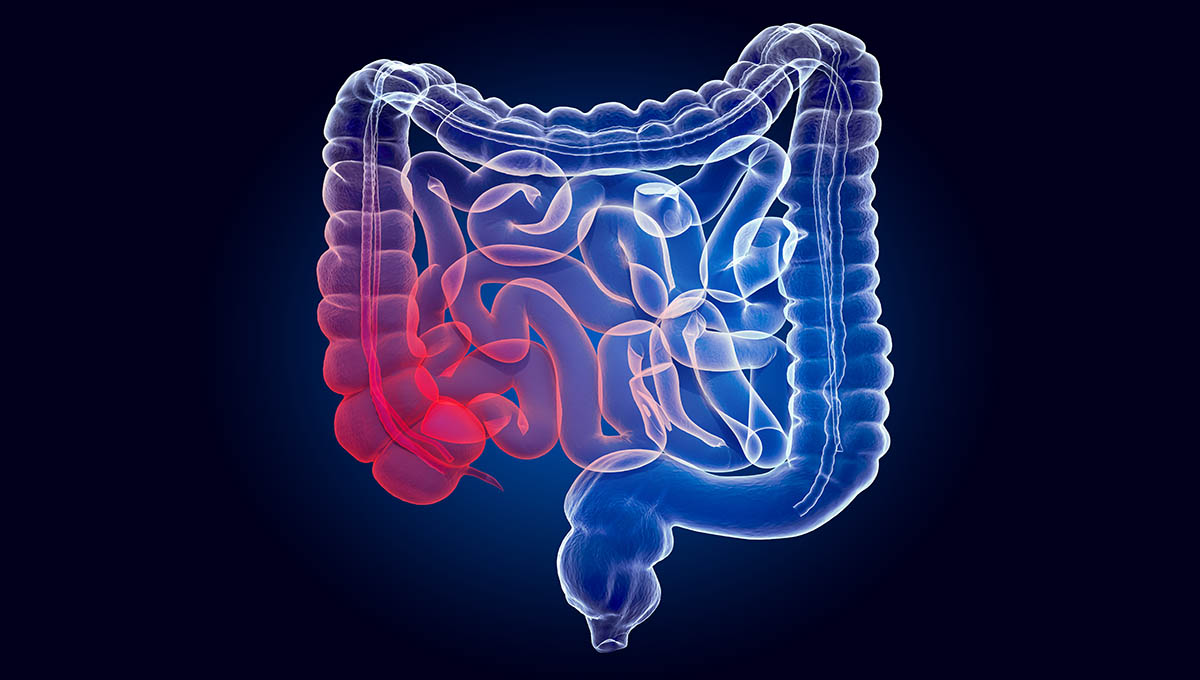Pain,In,Human,Intestines,,Bowel,Concept.,Ghost,Light,Effect,,X Ray