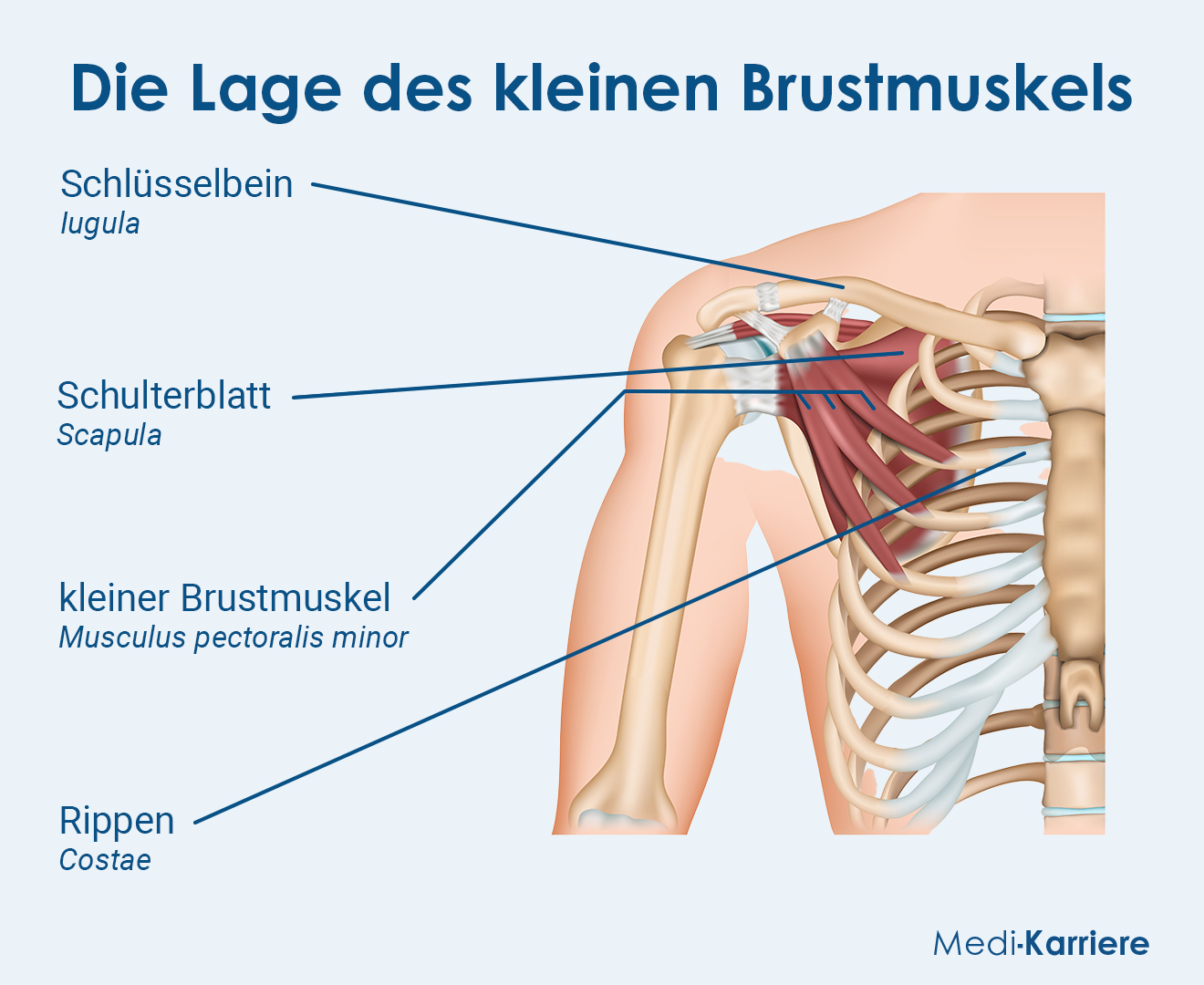 Kleiner Brustmuskel Grafik