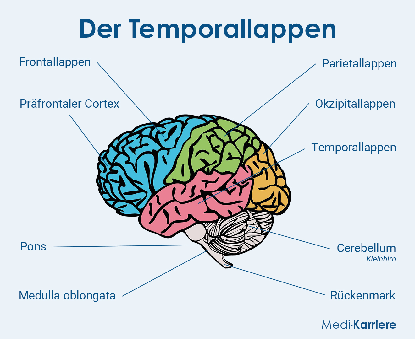 Temporallappen