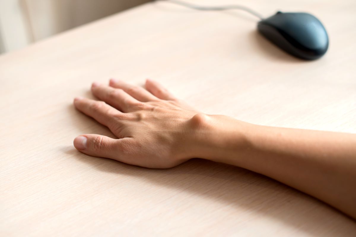 Ganglion