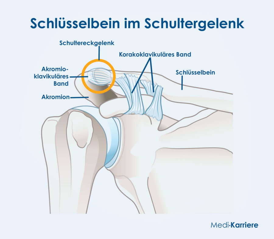 Grafik Schlüsselbein