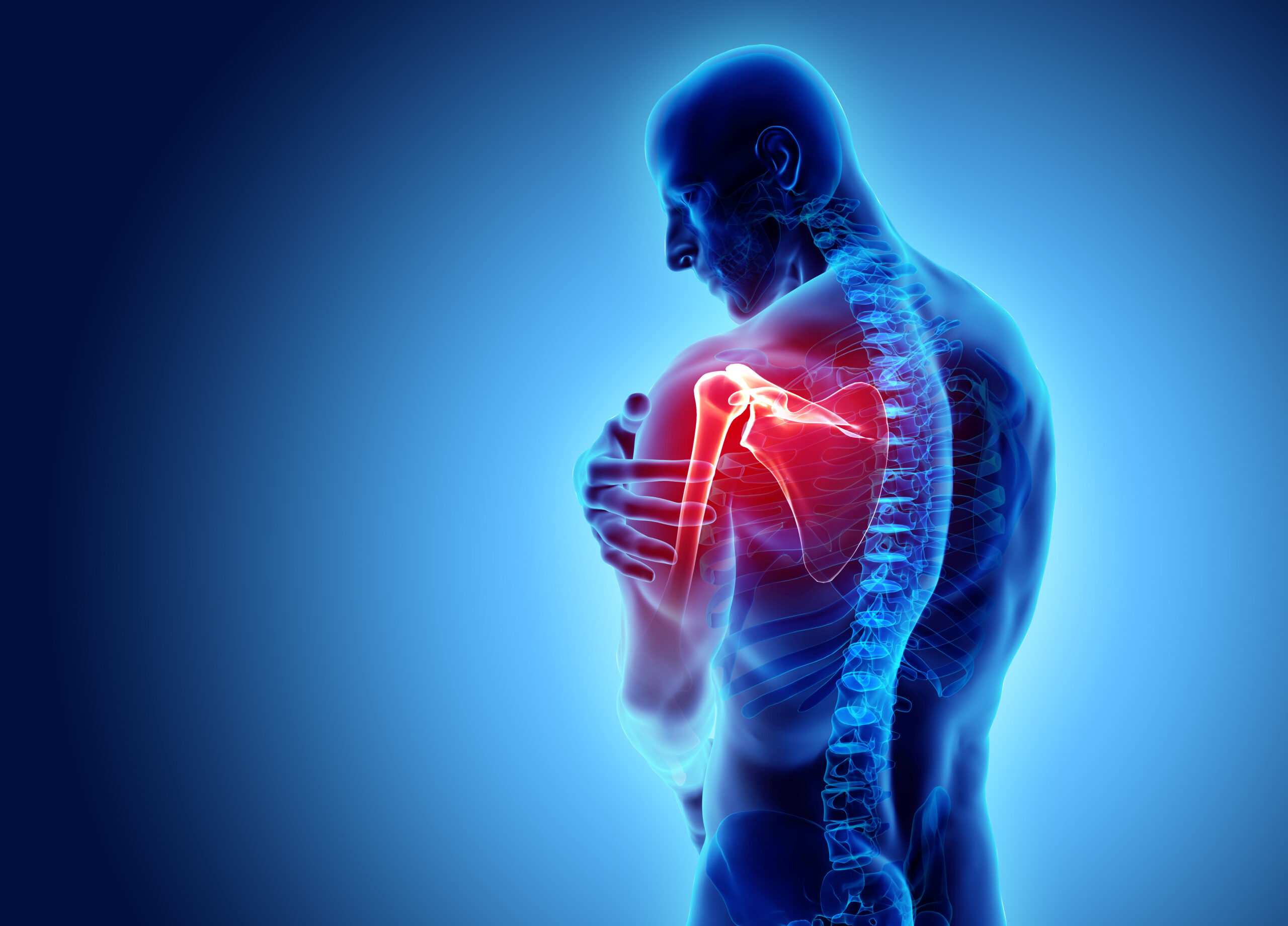 3d,Illustration,,Shoulder,Painful,Skeleton,X Ray,,Medical,Concept.