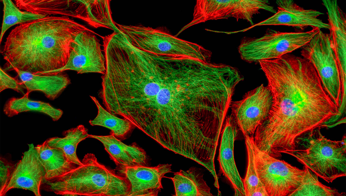 Bovine,Pulmonary,Artery,Endothelial,Cells,(bpae),Stained,For,Mitochondria,,Phalloidin,