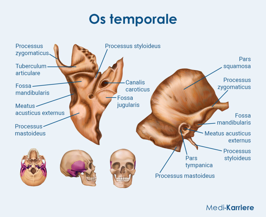 Os Temporal Anatomie Et Pathologies Associ es IIANB