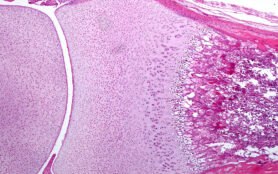 Bone,Joint.,The,Epiphysis,Are,Made,By,Hyaline,Cartilage.,In