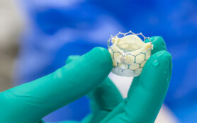 Heart,Valve,Surgery,Cardiology,For,Patient,In,Hospital.,Prepare,Transcatheter