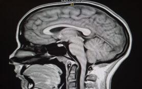 Sagittal,T1,Magnetic,Resonance,Image,Of,Brain