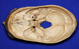 Cut,Skull,On,Blue,Background,,Top,View.