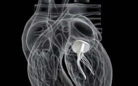 3d,Rendered,Medically,Accurate,Illustration,Of,The,Mitral,Valve