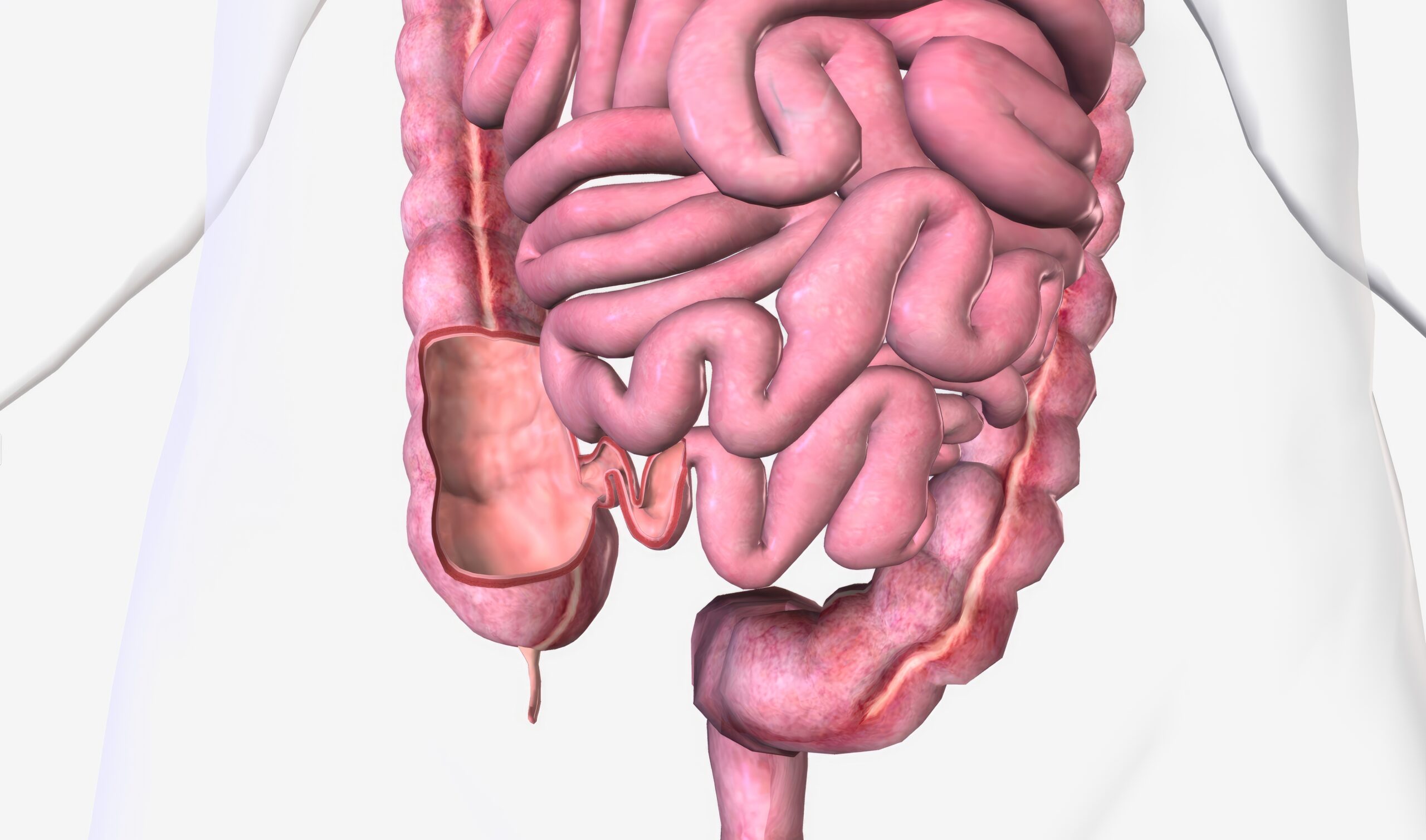 The,Ileocecal,Valve,Is,A,Papillose,Structure,With,A,Physiological