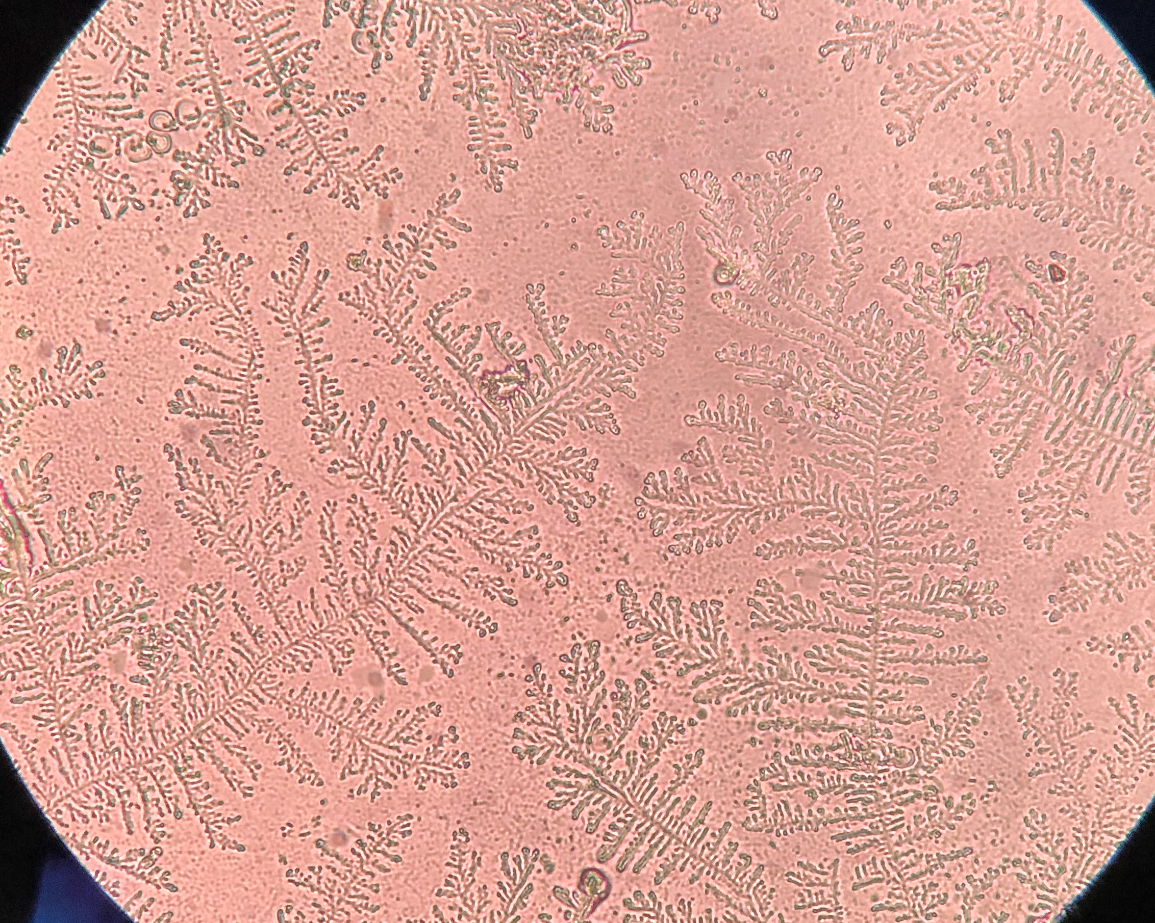 Under,Microscope,Showing,Fern,Test,Positive,Refers,To,Detection,Of