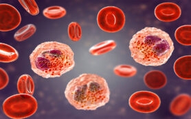 Eosinophilia,,Blood,Smear,Showing,Multiple,Eosinophils,Surround,By,Red,Blood