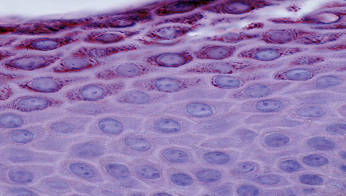 Light,Micrograph,Showing,The,Stratum,Spinosum,(bottom),And,The,Stratum
