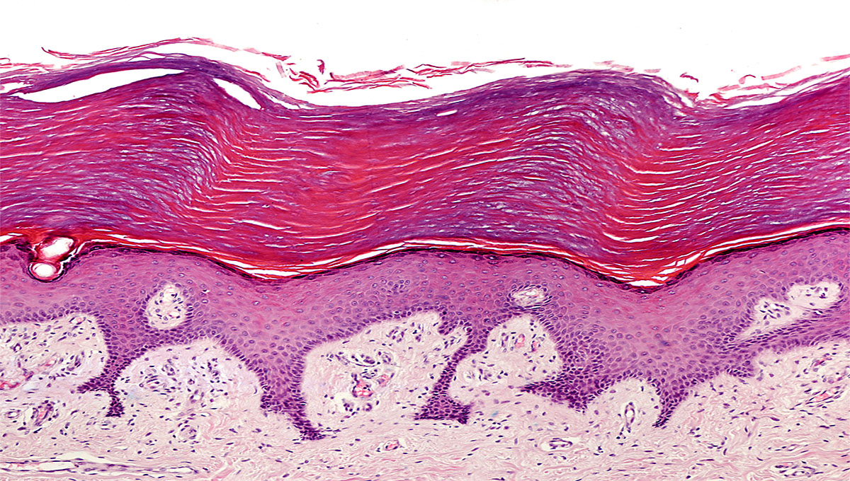 Keratinized,Stratified,Squamous,Epithelium,Of,The,Human,Glabrous,Skin,Showing