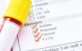 Blood,Sample,Tube,With,Laboratory,Requisition,Form,For,Electrolyte,Test