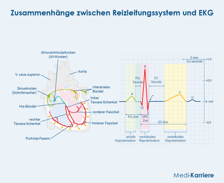 Tawara Schenkel Anatomie Aufgabe Und Schenkelblock tawara-schenkel-anatomie-aufgabe-und-schenkelblock