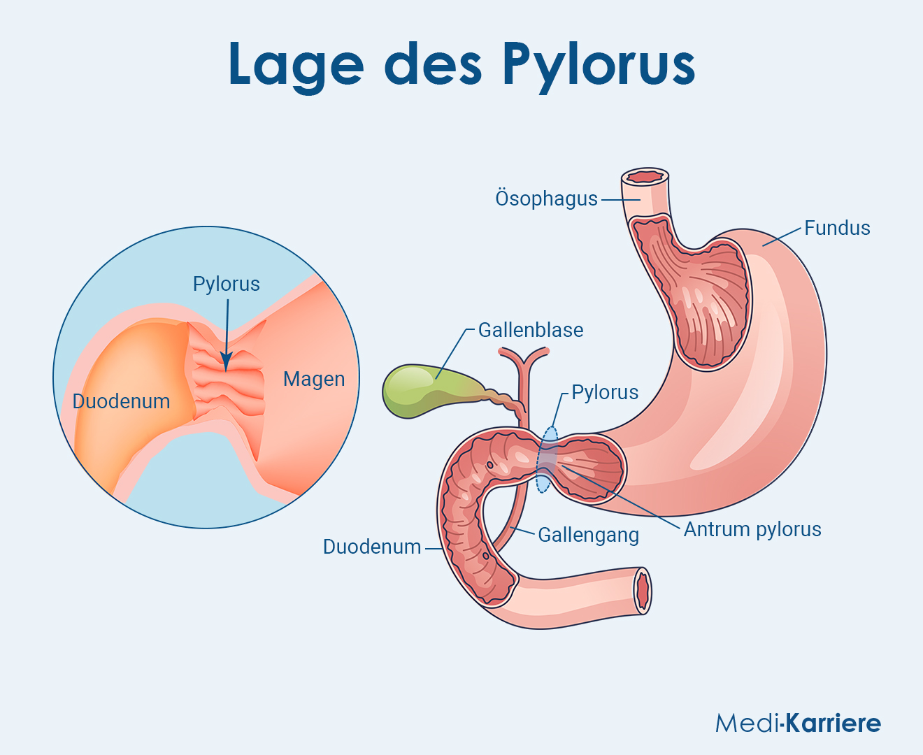 Pylorus Grafik