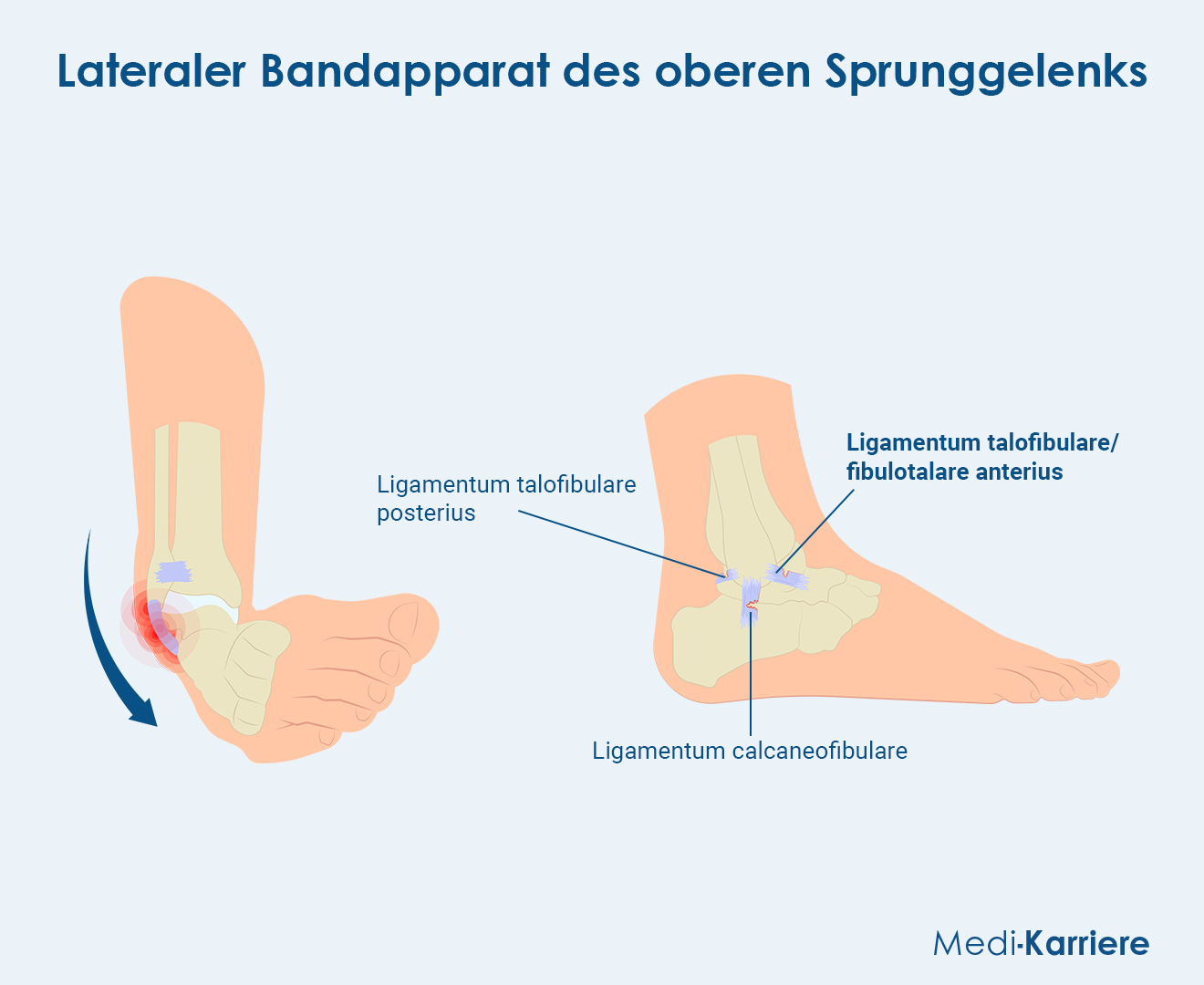 Ligamentum Fibulotalare Anterius Anatomie Und Schmerzen ligamentum-fibulotalare-anterius-anatomie-und-schmerzen
