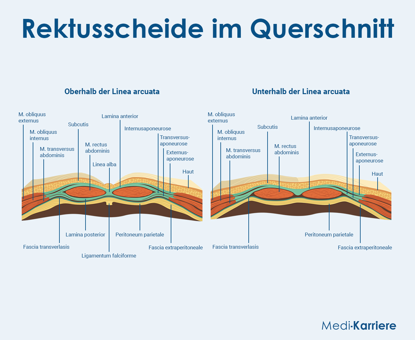 Rektusscheide Grafik