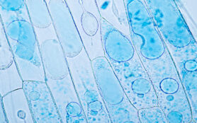 Cell,Structure,Plant,(onion),Showing,Under,The,Microscope,Classroom,Education.