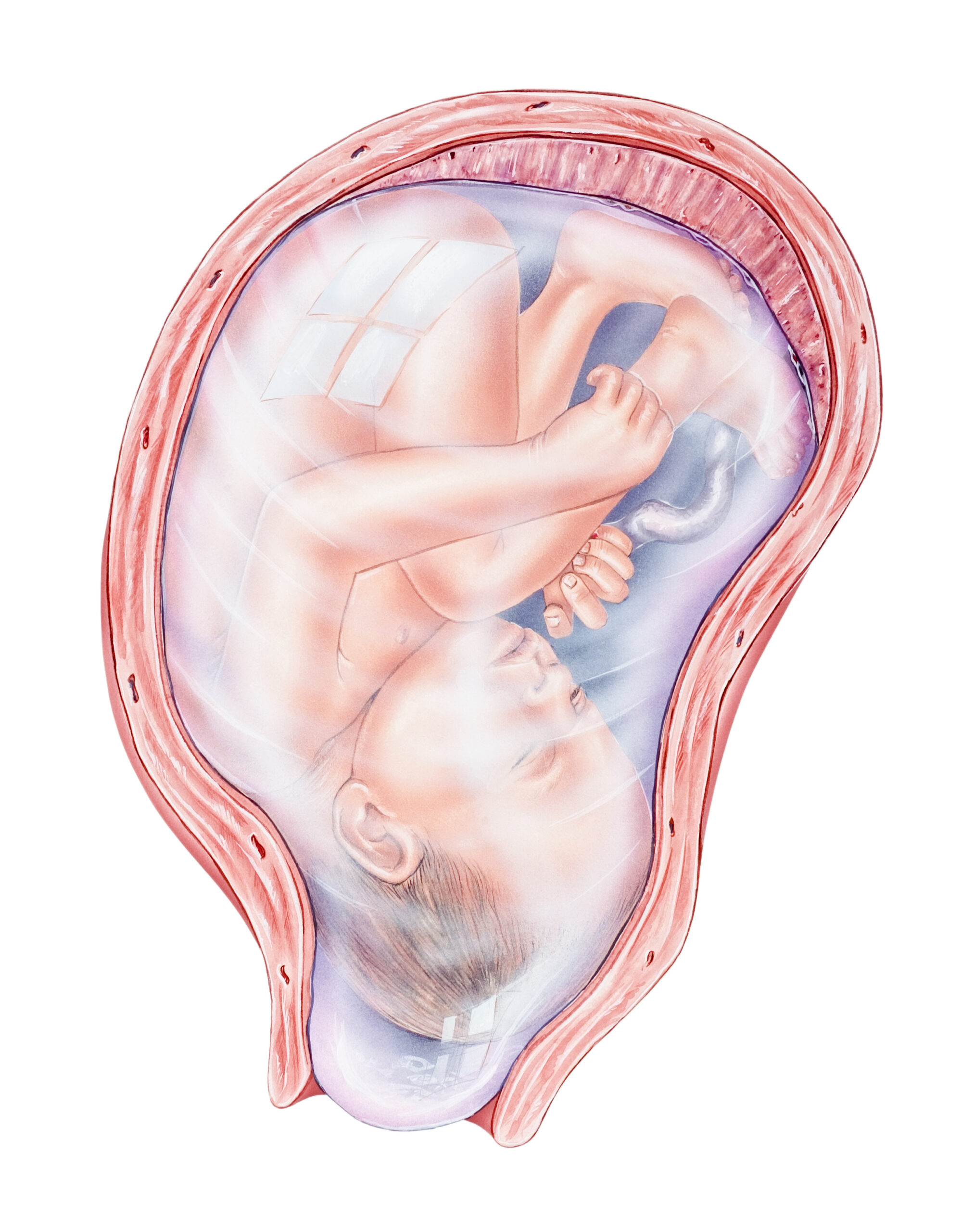 Pregnancy, ,Immature,(premature),Labor.,Shown,Are,The,Fetus,,Placenta