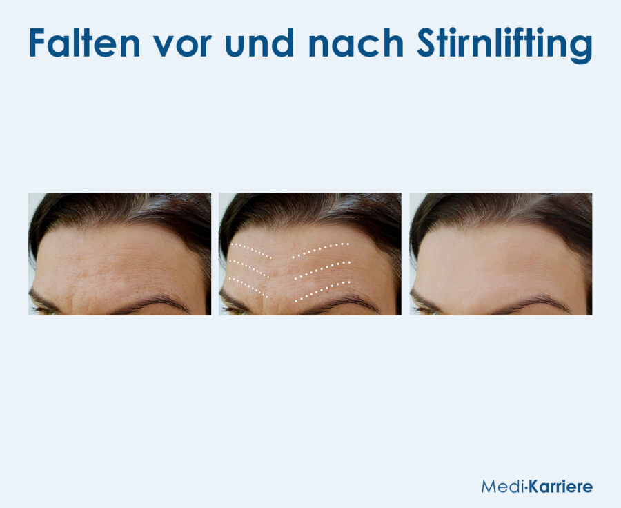 Grafik Stirn