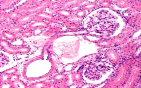 Kidney.,The,Micrograph,Shows,The,Continuity,Between,An,Interlobular,Artery