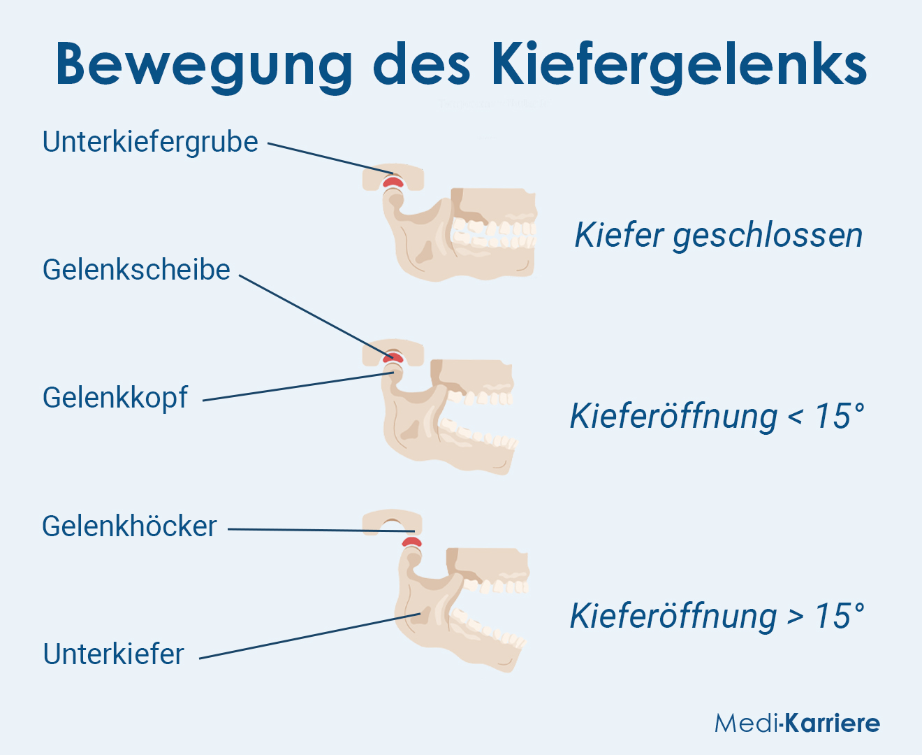 Kiefergelenk Grafik