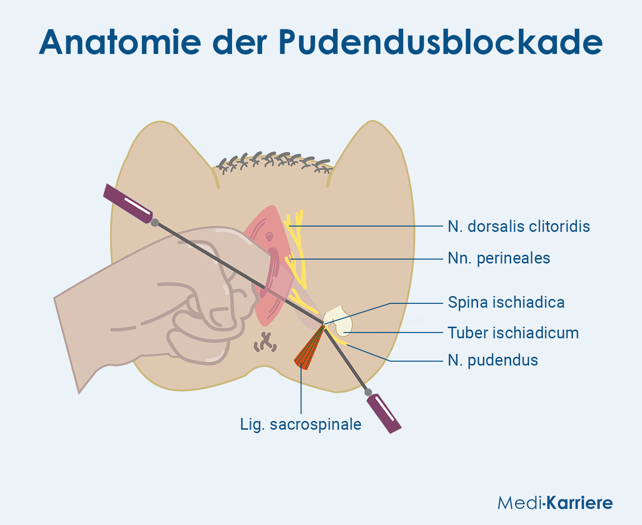 Nervus Pudendus Grafik