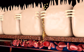 Leaky,Gut,,In,Intestine,With,Celiac,Disease,And,Gluten,Sensitivity