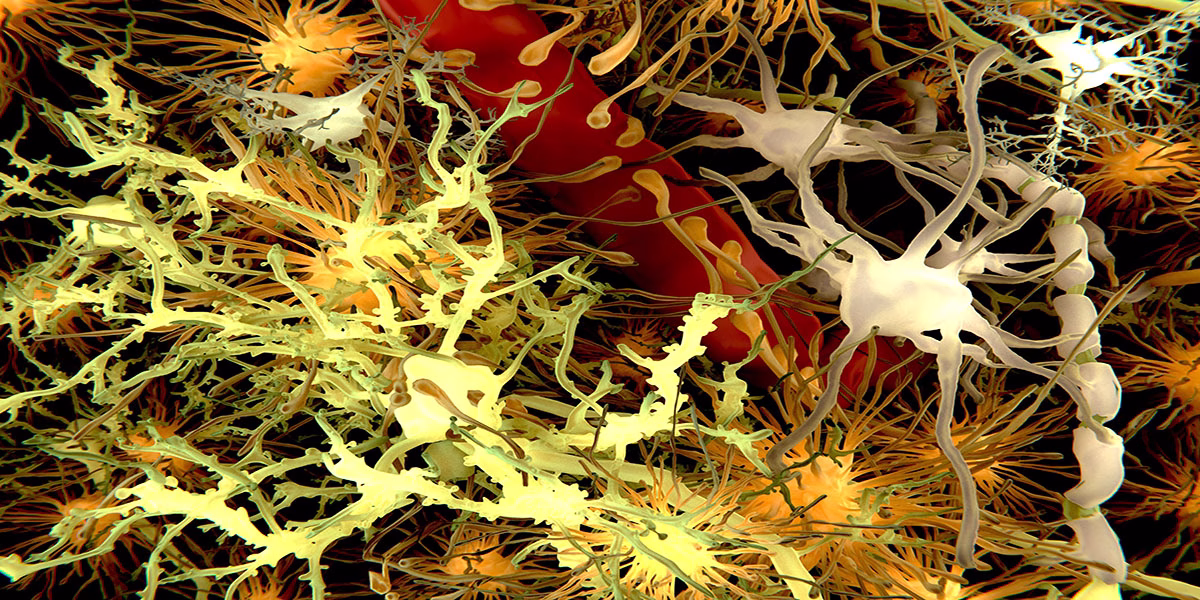 The,Main,Cells,Of,The,Brain:,Yellow:,Neurons;,Orange:,Astrocytes;