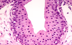 Transitional,Epithelium,(urothelium),Of,The,Ureter.,The,Epithelium,Shows,A