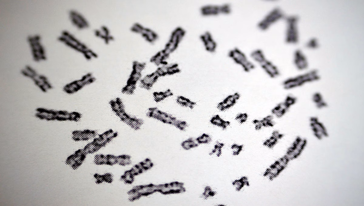 Normal,Female,Karyotyping,,46,Xx,,Specimen,Collected,From,Peripheral,Blood,