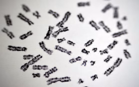 Normal,Female,Karyotyping,,46,Xx,,Specimen,Collected,From,Peripheral,Blood,