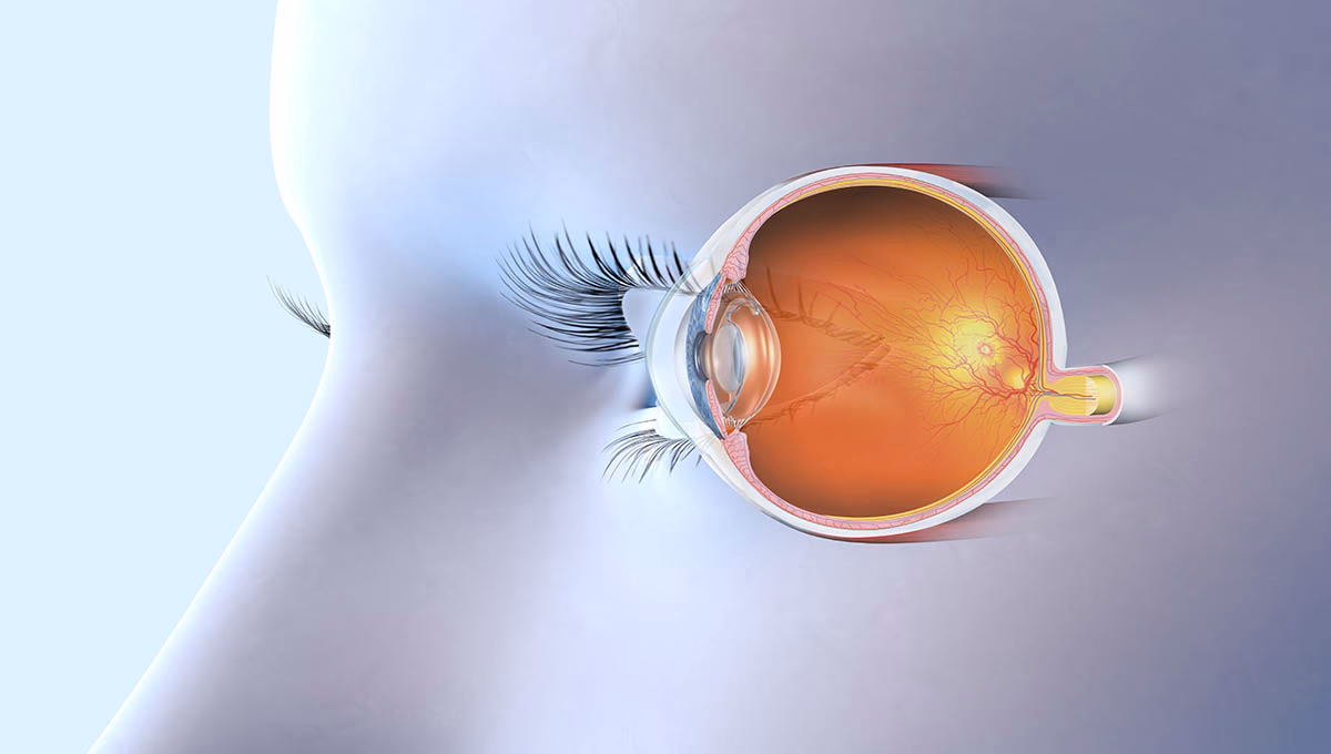 Medically,3d,Illustration,Showing,Human,Eye,With,Artificial,Lens,,Pupil,