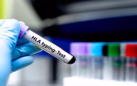 Blood,Sampling,Tube,For,Hla,Typing,Analysis.
