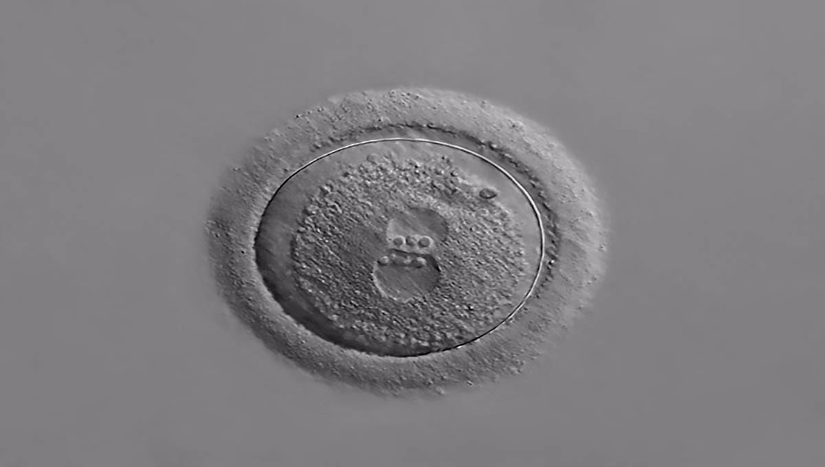 Photomicrograph,Of,An,Isolated,Human,Zygote,With,Two,Pronuclei,,20x