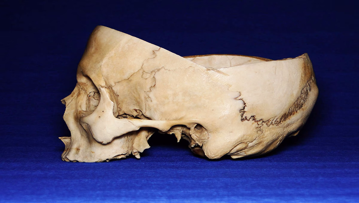 Cut,Real,Human,Skull,On,Blue,Background,,Side,View