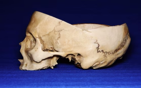 Cut,Real,Human,Skull,On,Blue,Background,,Side,View