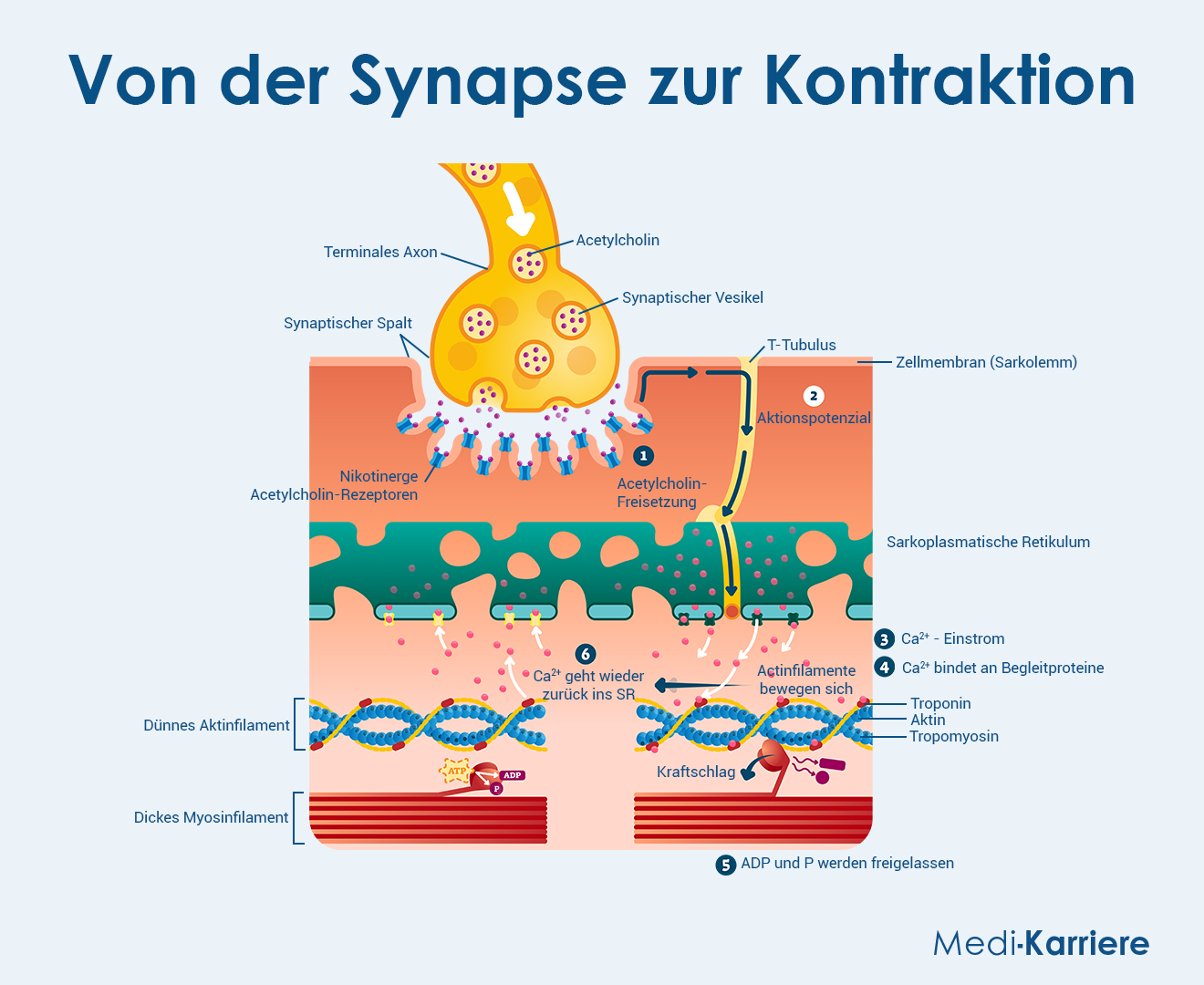 Kontraktion Grafik