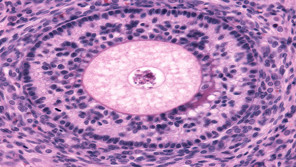 Secondary,Follicle,Showing,Oocyte,,Zona,Pellucida,,Several,Layers,Of,Granulosa
