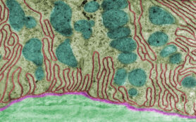 False,Colour,Transmission,Electron,Microscope,(tem),Micrograph,Showing,The,Basal
