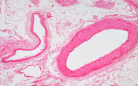 Artery,Vascular,Cross,Section,Under,The,Light,Microscope,View,For