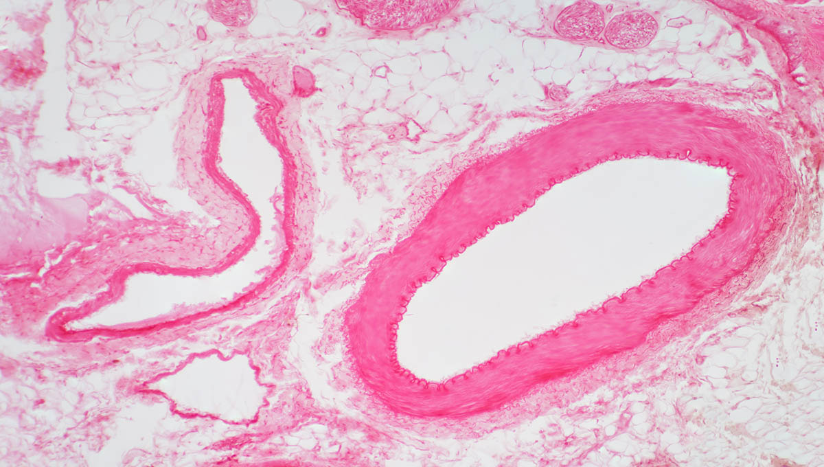 Artery,Vascular,Cross,Section,Under,The,Light,Microscope,View,For