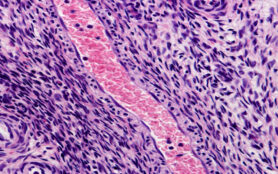 Longitudinally,Sectioned,Arteriole,Filled,With,Blood,,Located,On,The,Ovarian