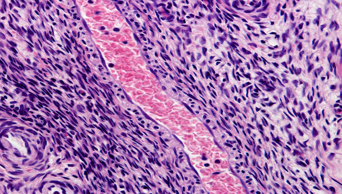 Longitudinally,Sectioned,Arteriole,Filled,With,Blood,,Located,On,The,Ovarian