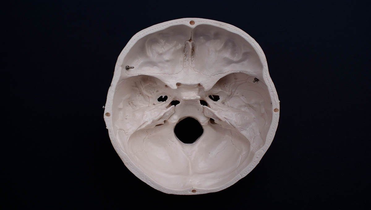 Interior,View,Of,Skull,With,Black,Background