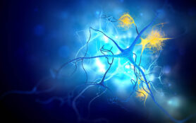 Neurons,Damaged,By,Alzheimer's,Disease,(3d,Illustration)