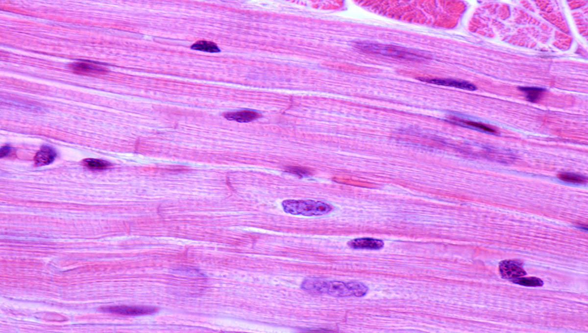 Striated,Muscle,Fibers,Of,The,Heart,Myocardium.,The,Cardiac,Myocytes